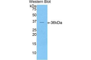 Western Blotting (WB) image for anti-Chemokine (C-X-C Motif) Ligand 5 (CXCL5) (AA 38-114) antibody (ABIN1077995) (CXCL5 抗体  (AA 38-114))