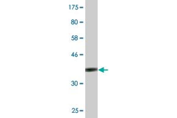 Cholesterol Esterase 抗体  (AA 378-477)