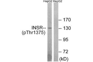 Western Blotting (WB) image for anti-IR (C-Term), (pThr1365), (pThr1375), (pThr1376) antibody (ABIN1847602) (IR (C-Term), (pThr1365), (pThr1375), (pThr1376) 抗体)