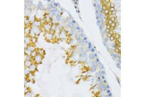 Immunohistochemistry of paraffin-embedded mouse testis using PTN Antibody. (Pleiotrophin 抗体)