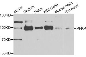 Western blot analysis of extracts of various cell lines, using PFKP antibody (ABIN5975671) at 1/1000 dilution. (PFKP 抗体)