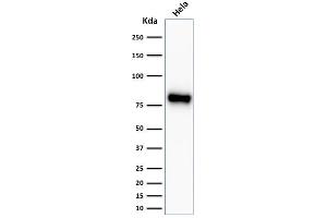 Western Blot Analysis of HeLa cell lysate using Beta-Catenin Recombinant Rabbit Monoclonal Antibody (CTNNB1/2030R). (Recombinant CTNNB1 抗体)
