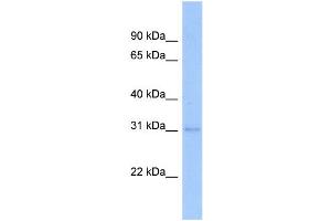 WB Suggested Anti-NFYB Antibody Titration:  0. (NFYB 抗体  (Middle Region))