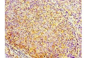 Immunohistochemistry of paraffin-embedded human tonsil tissue using ABIN7150705 at dilution of 1:100 (MAP2K3 抗体  (AA 1-170))