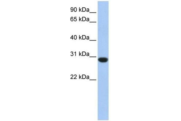 ASB12 抗体  (C-Term)