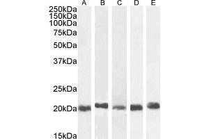 Western Blotting (WB) image for anti-Chromobox Homolog 3 (CBX3) (Internal Region) antibody (ABIN185493)