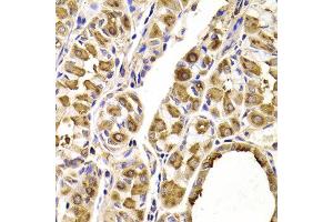 Immunohistochemistry of paraffin-embedded Human gastric using SEPT2 antibody at dilution of 1:100 (x400 lens). (Septin 2 抗体)