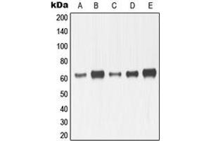 Western blot analysis of MMP14 expression in HeLa (A), HT1080 (B), MDMB23 (C), SP2/0 (D), mouse kidney (E), H9C2 (F) whole cell lysates. (MMP14 抗体  (C-Term))