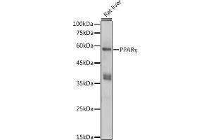 Western blot analysis of extracts of Rat liver, using PPARγ antibody (ABIN6134090, ABIN6146004, ABIN6146006 and ABIN6215096) at 1:1000 dilution. (PPARG 抗体  (AA 70-170))