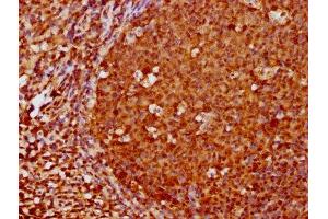 Immunohistochemistry (IHC) image for anti-Forkhead Box O3 (FOXO3) antibody (ABIN7127500)