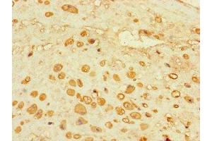 Immunohistochemistry of paraffin-embedded human placenta tissue using ABIN7143303 at dilution of 1:100 (Adenosine A2a Receptor 抗体  (AA 291-412))