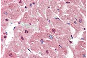 Human Heart (formalin-fixed, paraffin-embedded) stained with SIRT2 antibody ABIN461916 at 5 ug/ml followed by biotinylated goat anti-rabbit IgG secondary antibody ABIN481713, alkaline phosphatase-streptavidin and chromogen. (SIRT2 抗体  (N-Term))