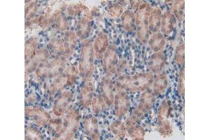 IHC-P analysis of kidney tissue, with DAB staining. (HSD17B12 抗体  (AA 1-312))