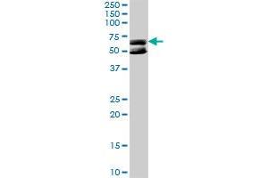 KLHDC4 MaxPab rabbit polyclonal antibody. (KLHDC4 抗体  (AA 1-520))