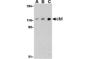 Western Blotting (WB) image for anti-Cas-Br-M (Murine) Ecotropic Retroviral Transforming Sequence (CBL) (C-Term) antibody (ABIN1030323) (CBL 抗体  (C-Term))