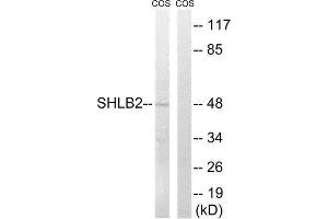 Western Blotting (WB) image for anti-SH3-Domain GRB2-Like Endophilin B2 (SH3GLB2) (Internal Region) antibody (ABIN1852154) (SH3GLB2 抗体  (Internal Region))