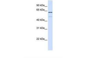 Image no. 1 for anti-Methyltransferase Like 16 (METTL16) (AA 38-87) antibody (ABIN6738395) (METTL16 抗体  (AA 38-87))