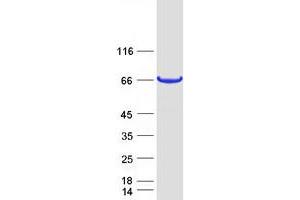 Validation with Western Blot (METTL25 Protein (Myc-DYKDDDDK Tag))