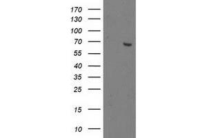 Western Blotting (WB) image for anti-2-Oxoglutarate and Iron-Dependent Oxygenase Domain Containing 1 (OGFOD1) antibody (ABIN1499911) (OGFOD1 抗体)