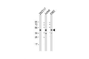 Western Blot at 1:2000 dilution Lane 1: 293T/17 whole cell lysate Lane 2: Jurkat whole cell lysate Lane 3: K562 whole cell lysate Lysates/proteins at 20 ug per lane. (PHF6 抗体  (AA 148-180))