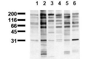 Western Blotting (WB) image for anti-Phosphotyrosine (phosphorylated) antibody (Biotin) (ABIN126872) (Phosphotyrosine 抗体  (phosphorylated) (Biotin))