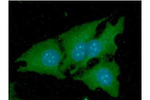 ICC/IF analysis of NNMT in HeLa cells line, stained with DAPI (Blue) for nucleus staining and monoclonal anti-human NNMT antibody (1:100) with goat anti-mouse IgG-Alexa fluor 488 conjugate (Green). (NNMT 抗体)