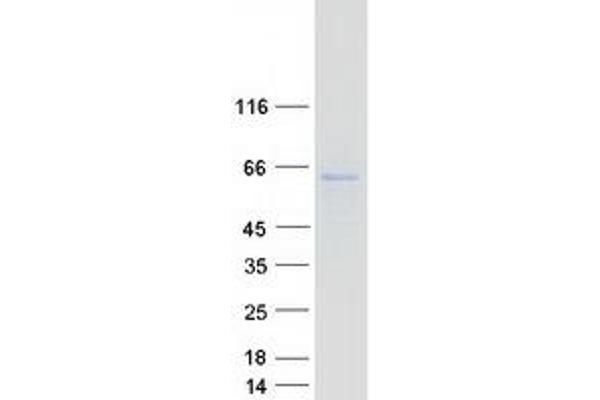 PPAT Protein (Myc-DYKDDDDK Tag)