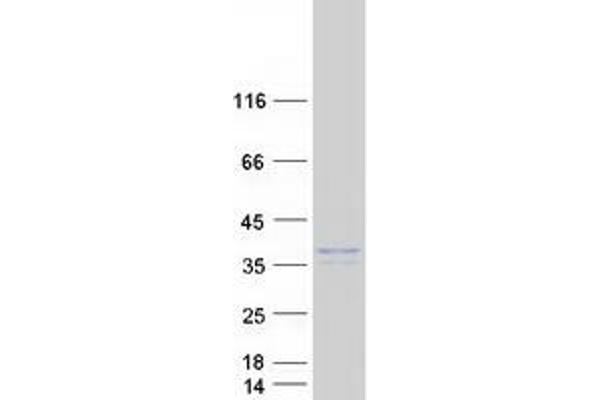 RAB36 Protein (Myc-DYKDDDDK Tag)