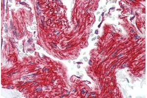 Human Vessel (formalin-fixed, paraffin-embedded) stained with ITGB1 antibody ABIN396958 at 10 ug/ml followed by biotinylated anti-mouse IgG secondary antibody ABIN481714, alkaline phosphatase-streptavidin and chromogen. (ITGB1 抗体)