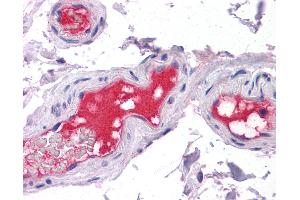 Anti-PROC / Protein C antibody IHC of human vessels. (PROC 抗体)