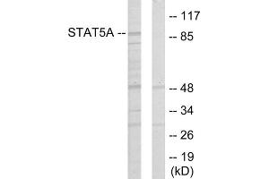 Western blot analysis of extracts from 293 cells, using STAT5A antibody. (STAT5A 抗体  (Internal Region))