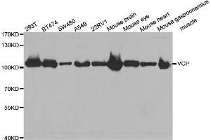 Western blot analysis of extracts of various cell lines, using VCP antibody (ABIN5971478) at 1:300 dilution. (VCP 抗体)