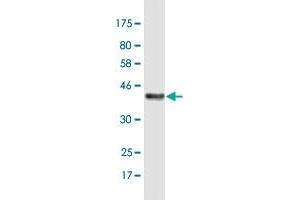 Western Blot detection against Immunogen (38. (C17orf37 抗体  (AA 1-115))