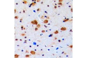 Immunohistochemical analysis of Topoisomerase 3 beta1 staining in human brain formalin fixed paraffin embedded tissue section. (Topoisomerase 3 Beta1 (N-Term) 抗体)