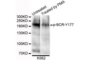 Western blot analysis of extracts of K562 cells, using Phospho-BCR-Y177 antibody. (BCR 抗体  (pTyr177))