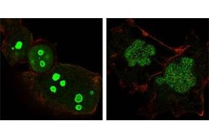 Confocal immunofluorescence analysis of Hela (left) and NTERA-2 (right) cells using NPM antibody (green). (NPM1 抗体)
