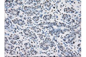 Immunohistochemical staining of paraffin-embedded breast tissue using anti-PPP5C mouse monoclonal antibody. (PP5 抗体)