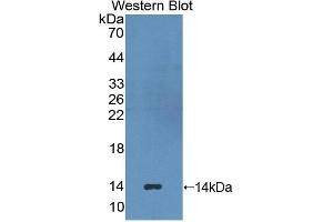 Western blot analysis of the recombinant protein. (HAVCR1 抗体  (AA 23-125))