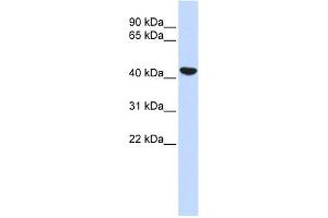 Cytokeratin 19 antibody used at 1 ug/ml to detect target protein. (Cytokeratin 19 抗体  (N-Term))