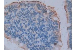 DAB staining on IHC-P; Samples: Rat Small intestine Tissue (ACE2 抗体  (AA 392-739))