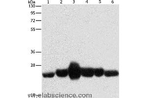 Western blot analysis of Human fetal muscle and fetal lung tissue, Human leiomyosarcoma tissue, mouse lung and heart tissue,  NIH/3T3 cell, using CAV1 Polyclonal Antibody at dilution of 1:550 (Caveolin-1 抗体)