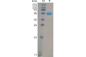 Human F Protein, mFc Tag on SDS-PAGE under reducing condition. (FOLR2 Protein (AA 17-228) (mFc Tag))