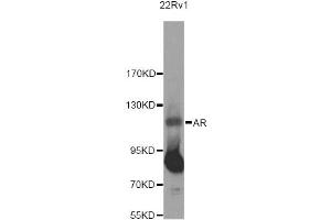 Western Blotting (WB) image for anti-Androgen Receptor (AR) antibody (ABIN1871059)