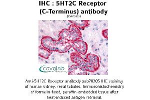 Image no. 1 for anti-5-Hydroxytryptamine (serotonin) Receptor 2C (HTR2C) (C-Term) antibody (ABIN1731369) (HTR2C 抗体  (C-Term))