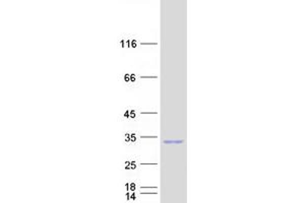 RND3 Protein (Myc-DYKDDDDK Tag)