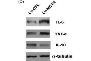 MCT4 modulates various inflammatory cytokines expression. (IL-10 抗体  (AA 19-178))