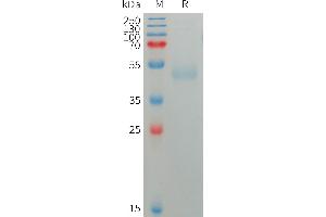 Human SIRPG Protein, His Tag on SDS-PAGE under reducing condition. (SIRPG Protein (AA 29-364) (His tag))