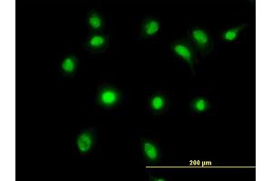 Immunofluorescence of monoclonal antibody to LDB2 on HeLa cell. (LIM Domain Binding 2 Protein 抗体  (AA 1-373))