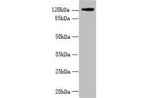Western blot All lanes: SLC4A8 antibody at 2 μg/mL + Hela whole cell lysate Secondary Goat polyclonal to rabbit IgG at 1/10000 dilution Predicted band size: 123, 121, 118, 112, 78, 84, 72 kDa Observed band size: 123 kDa (SLC4A8 抗体  (AA 1-300))