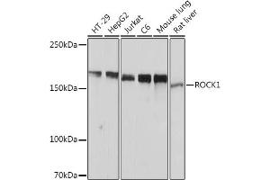 Western blot analysis of extracts of various cell lines, using ROCK1 Rabbit mAb (ABIN6129453, ABIN6135894, ABIN6135895 and ABIN7101375) at 1:1000 dilution. (ROCK1 抗体)